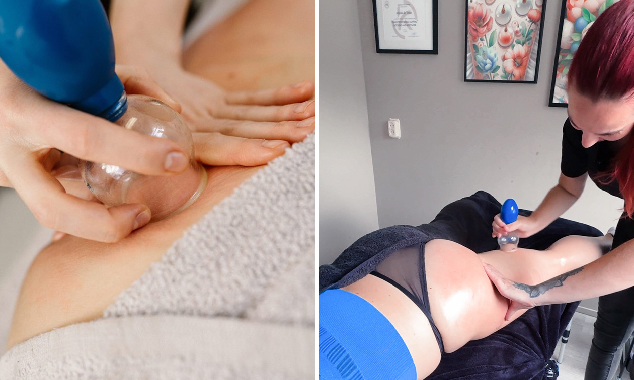 Beauty en cupping Drenthe