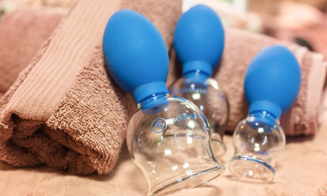 Beauty en cupping Drenthe