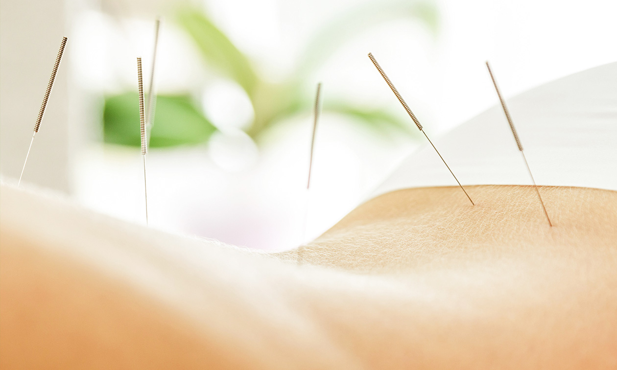 Rhea Praktijk voor Acupunctuur