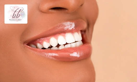 Zahnbleaching (60 Minuten) in Bonn