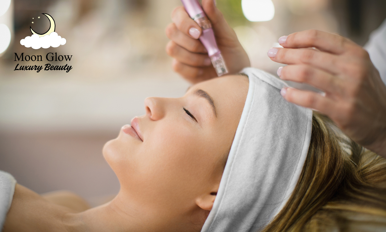 Microneedling für eine Zone nach Wahl in Düsseldorf (50, 70 oder 90 Min.)
