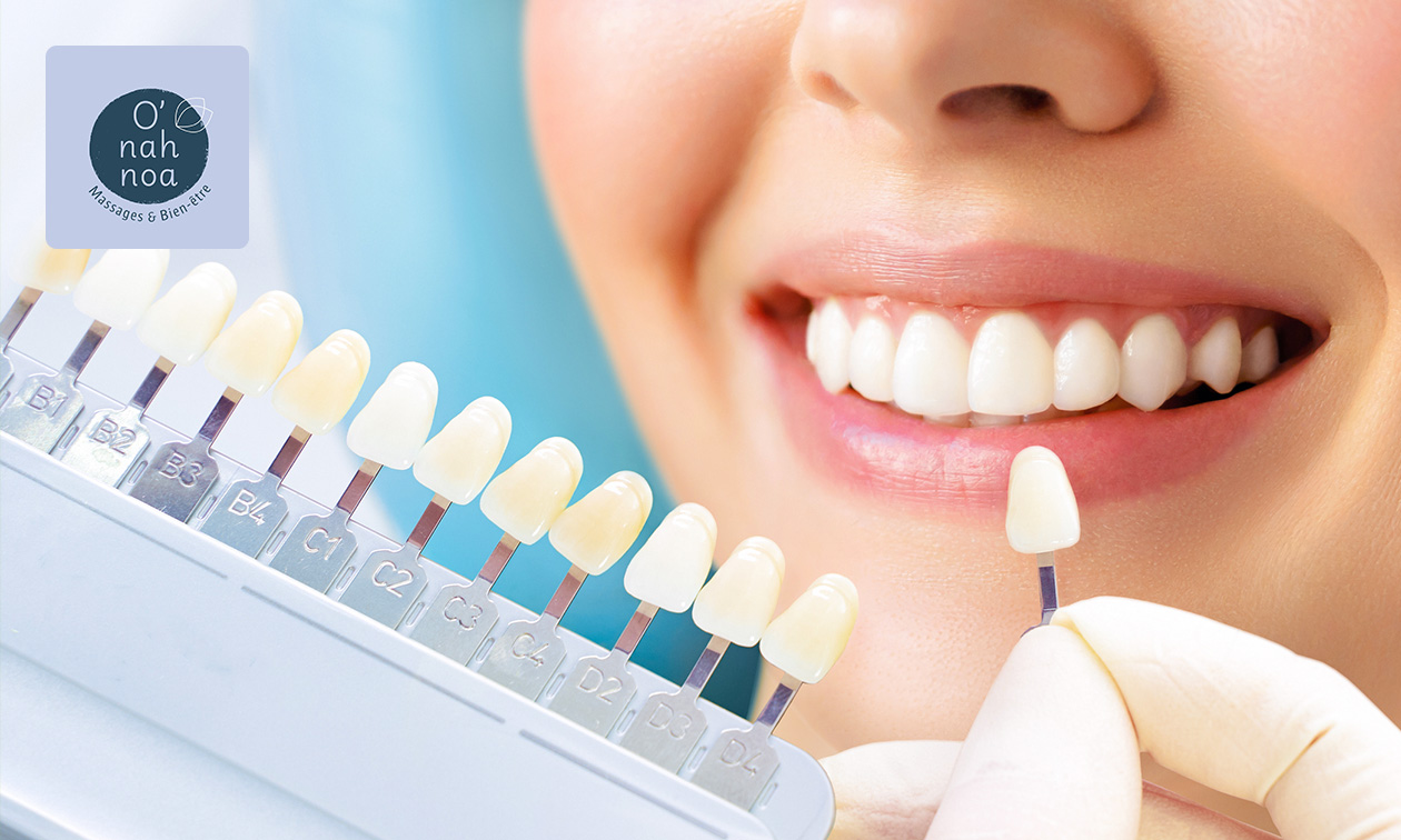 2 ou 3 séances de blanchiment dentaire (40 ou 60 min) près de Liège