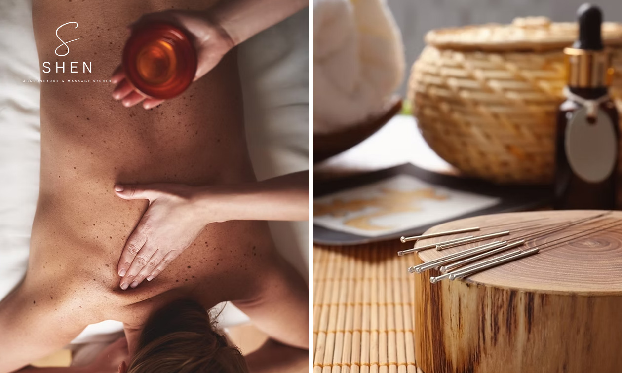 Ontspanningsmassage of acupunctuurbehandeling + cupping, Gua Sha of massage Ontspanningsmassage of acupunctuurbehandeling + cupping, Gua Sha of massage